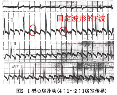 15e27edc9a5cec131729dbaa5db9db34.png